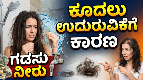 ಗಡಸು ನೀರು ಕೂದಲು ಉದುರುವಿಕೆಗೆ ಕಾರಣ