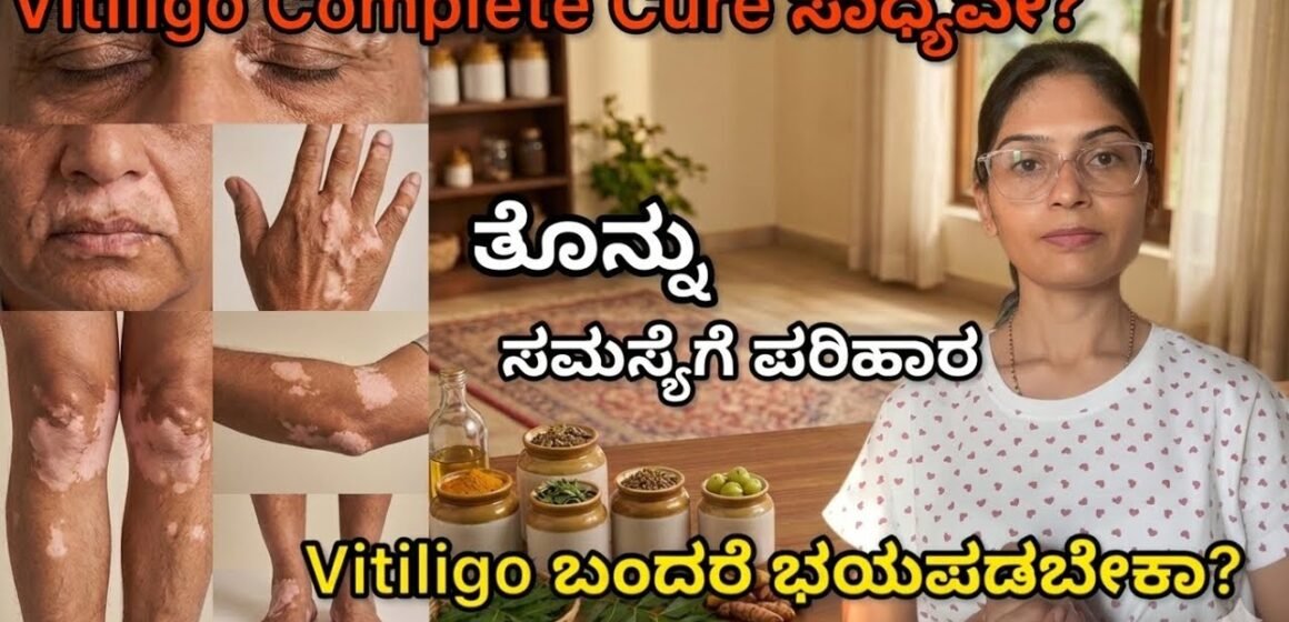 ಚರ್ಮದ ಮೇಲೆ ಸಣ್ಣ ಬಿಳಿ ಕಲೆ ಅಥವಾ White patches ಕಾಣಿಸಿಕೊಂಡಿದೆಯಾ? Ignore ಮಾಡ್ಬೇಡಿ | Vitiligo /ತೊನ್ನು