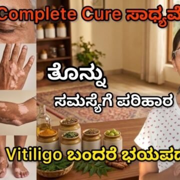ಚರ್ಮದ ಮೇಲೆ ಸಣ್ಣ ಬಿಳಿ ಕಲೆ ಅಥವಾ White patches ಕಾಣಿಸಿಕೊಂಡಿದೆಯಾ? Ignore ಮಾಡ್ಬೇಡಿ | Vitiligo /ತೊನ್ನು